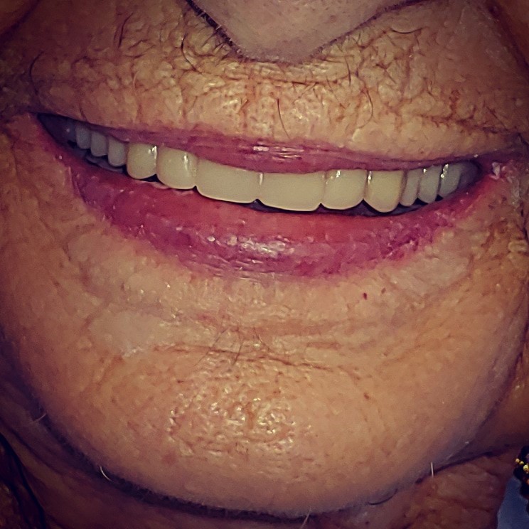 Lower Mainland Denture Centre | 12460 191 St C2, Pitt Meadows, BC V3Y 2J2, Canada | Phone: (604) 457-3763