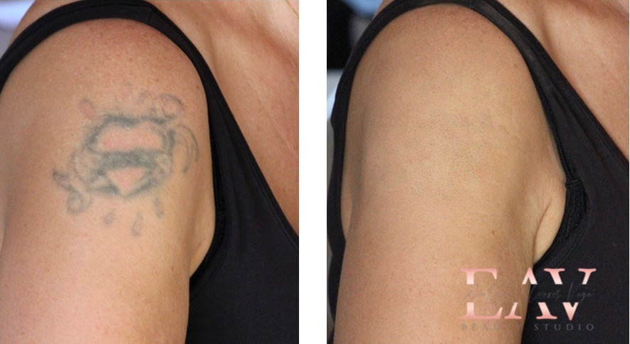 EAV Cosmetic Tattoo Studio | 7601 Bathurst St, Vaughan, ON L4J 4H5, Canada | Phone: (647) 898-7105