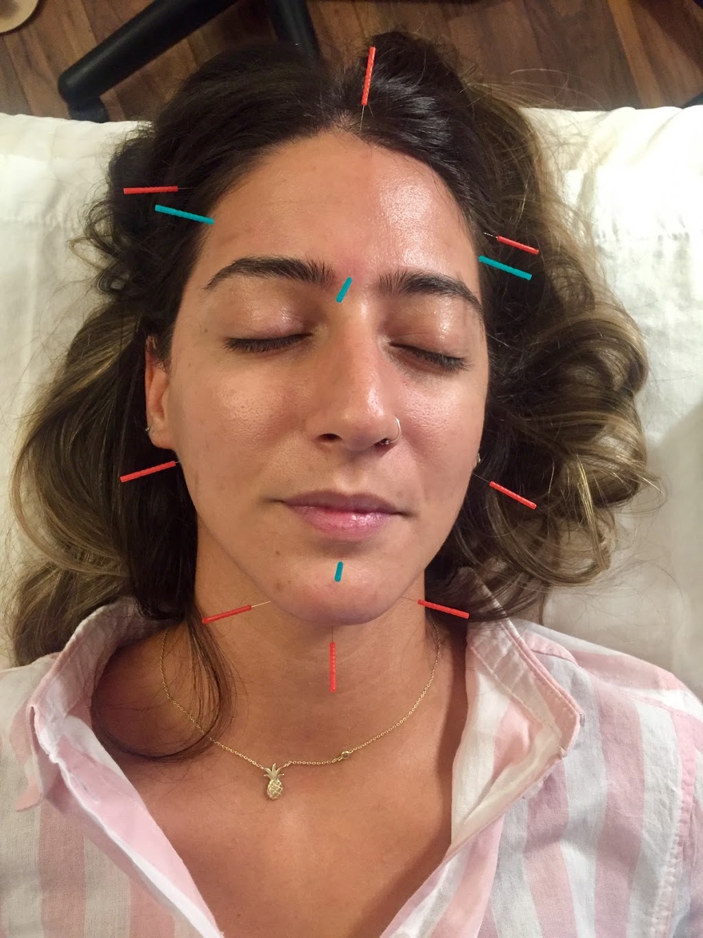 Bahareh Hosseini, Registered Acupuncturist, Shiatsu Therapist | 116 Church St S, Richmond Hill, ON L4C 1W3, Canada | Phone: (905) 883-9355