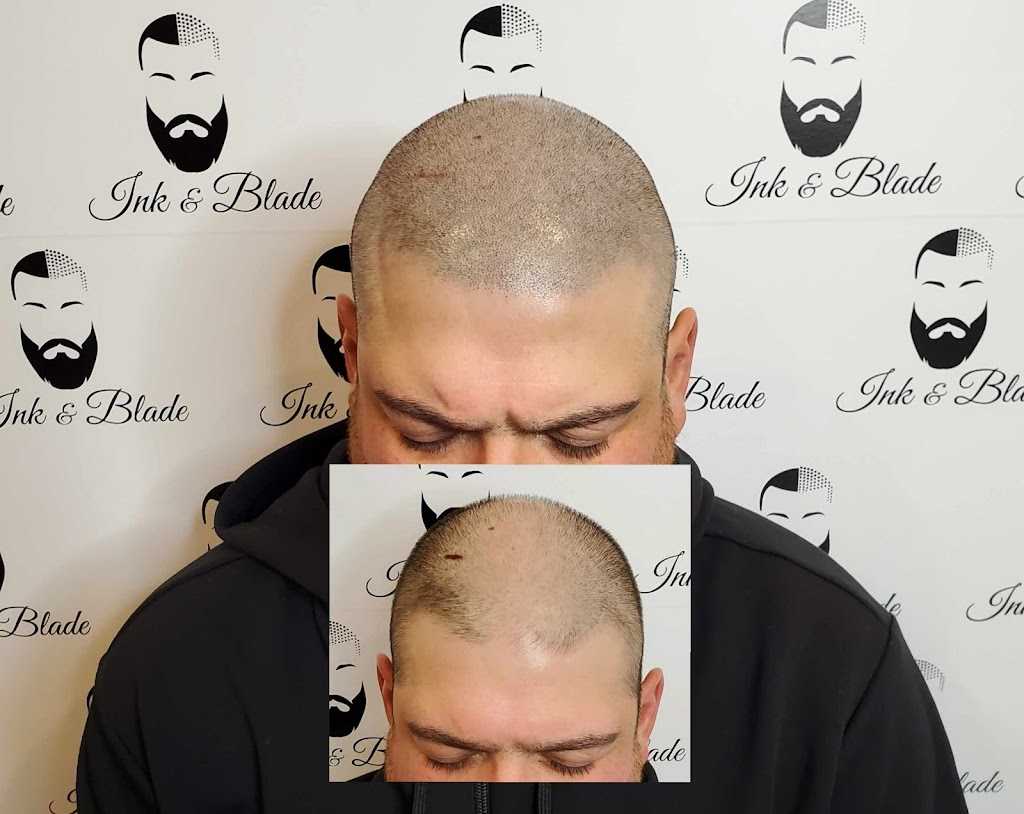 Ink and Blade - Micropigmentation Capillaire | 87 Boulevard Saint-Elzéar O, Laval, QC H7M 1E7, Canada | Phone: (438) 879-2417