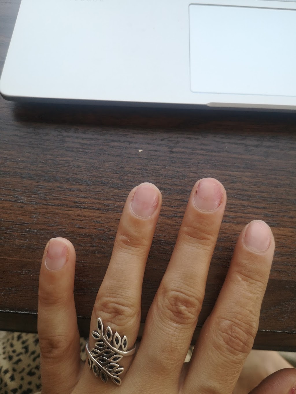 Pro-Ongles | 338 Rue Principale, Granby, QC J2G 2W4, Canada | Phone: (450) 375-9852