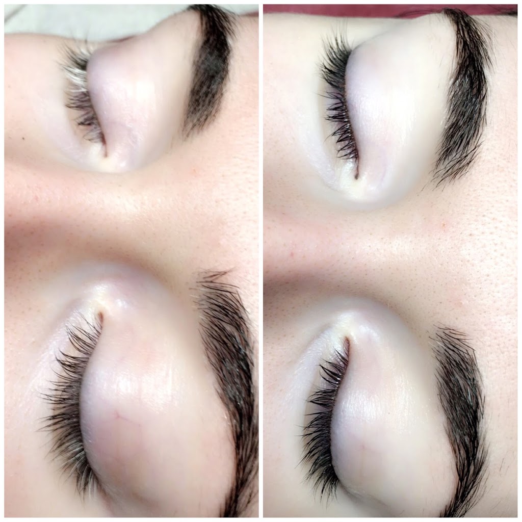 VIP laser & Esthetics | 355 Boulevard Samson, Laval, QC H7X 2Z7, Canada | Phone: (514) 796-2660