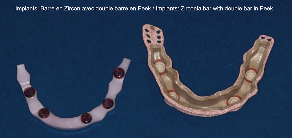 Dentoflex inc. Laboratoire dentaire | 871 Rue Mélanie, Laval, QC H7X 3V3, Canada | Phone: (450) 969-0148