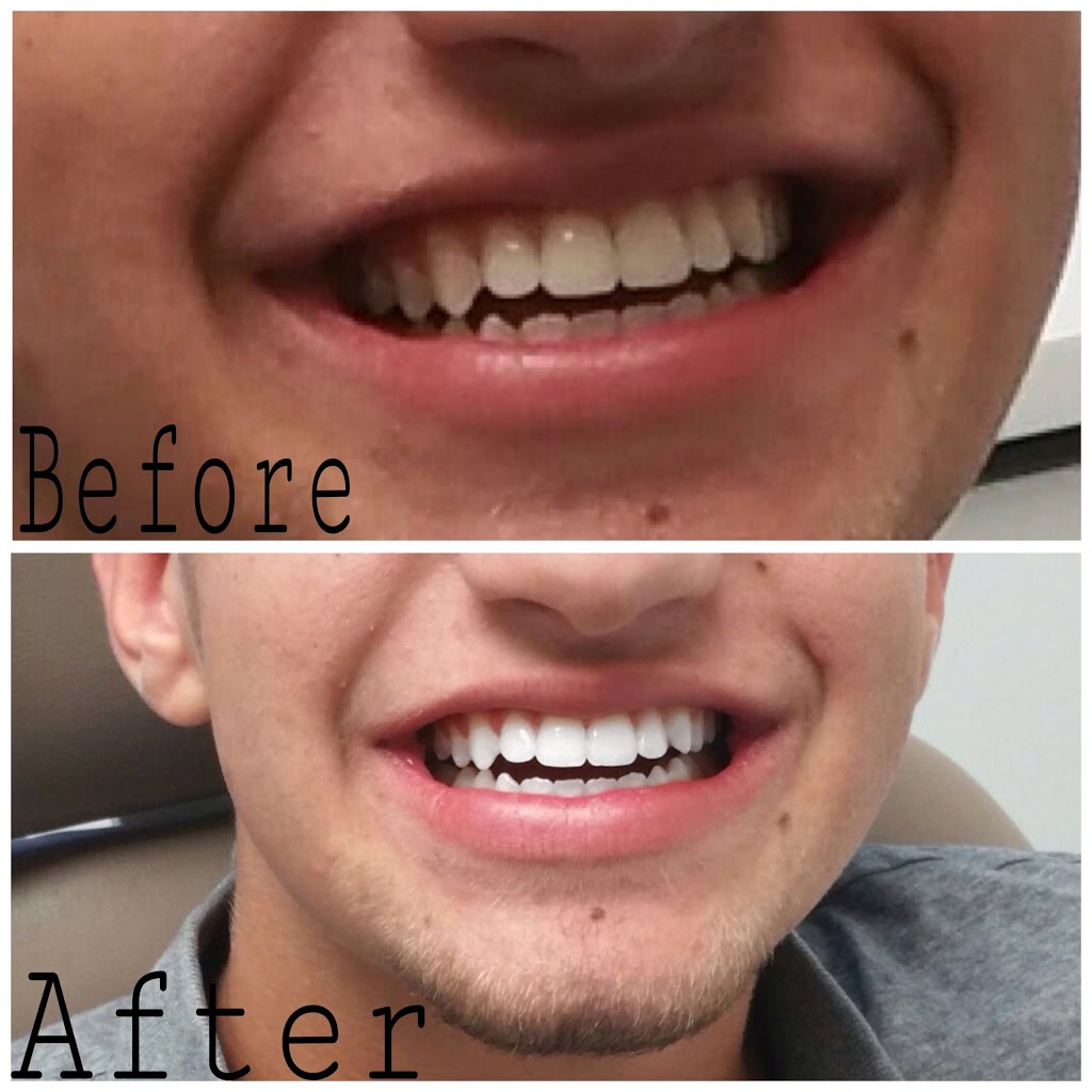 Happy Smile Denture Clinic | 2354 Major MacKenzie Dr W, Maple, ON L6A 3Y7, Canada | Phone: (905) 303-5550