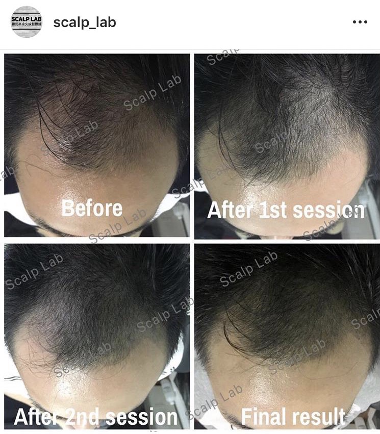 Scalp Lab | 135 Village Green Square, Scarborough, ON M1S 0G4, Canada | Phone: (416) 823-9300