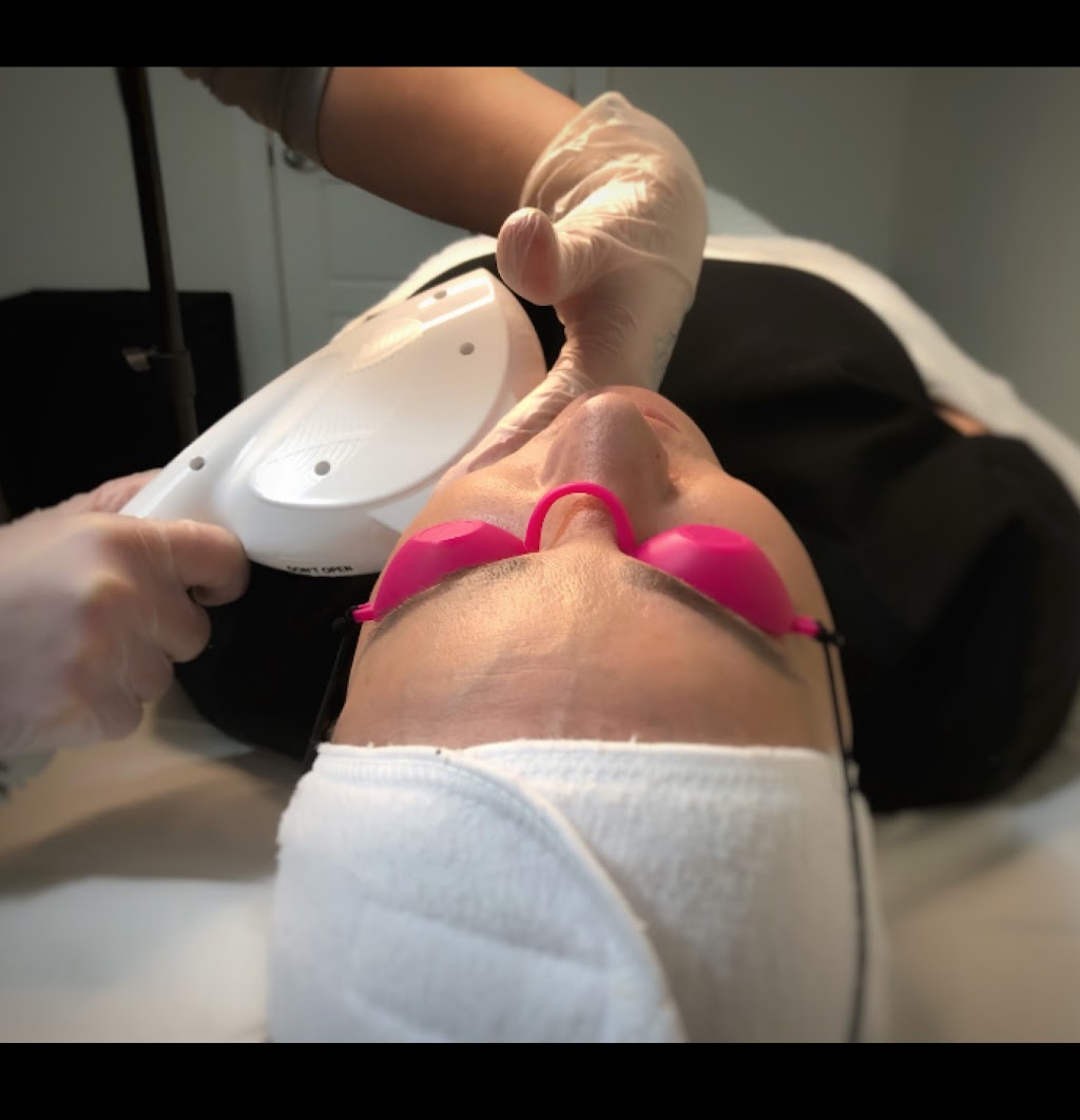 NuYou MedSpa + laser clinic | 671 Larry Uteck Blvd Suite 407, Bedford, NS B4A 4H4, Canada | Phone: (902) 422-7327