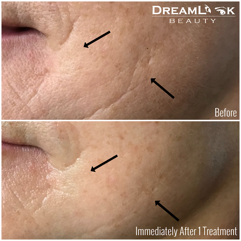 DreamLook Beauty | 21176 Cook Ave, Maple Ridge, BC V2X 7P8, Canada | Phone: (604) 831-6314
