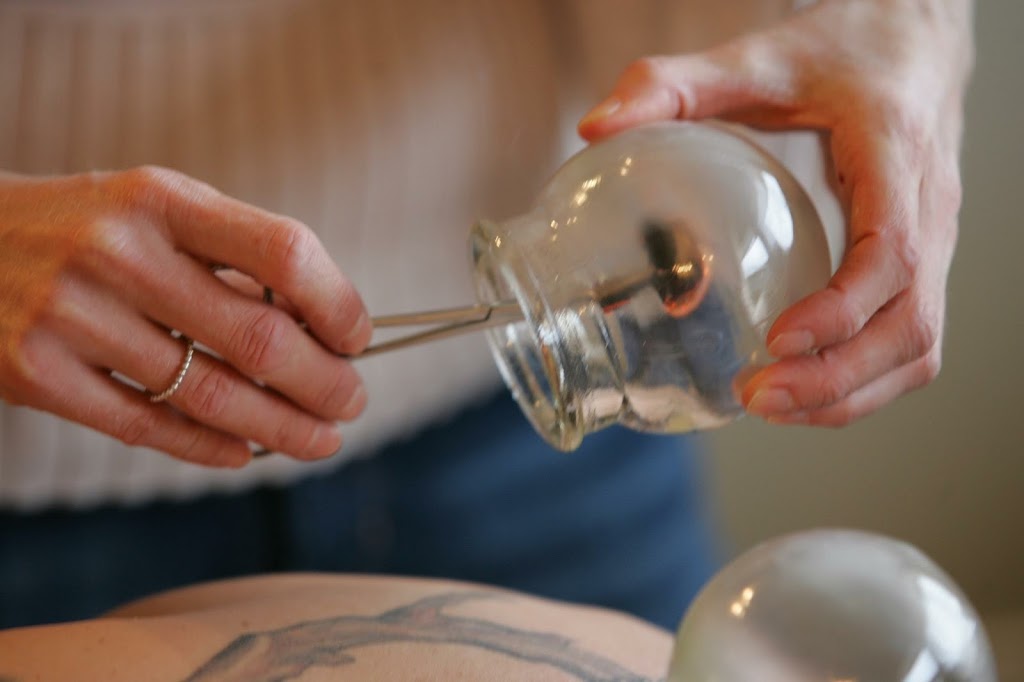 Embrace Acupuncture | 312 Fifth Ave, Cochrane, AB T4C 2A7, Canada | Phone: (403) 678-7970