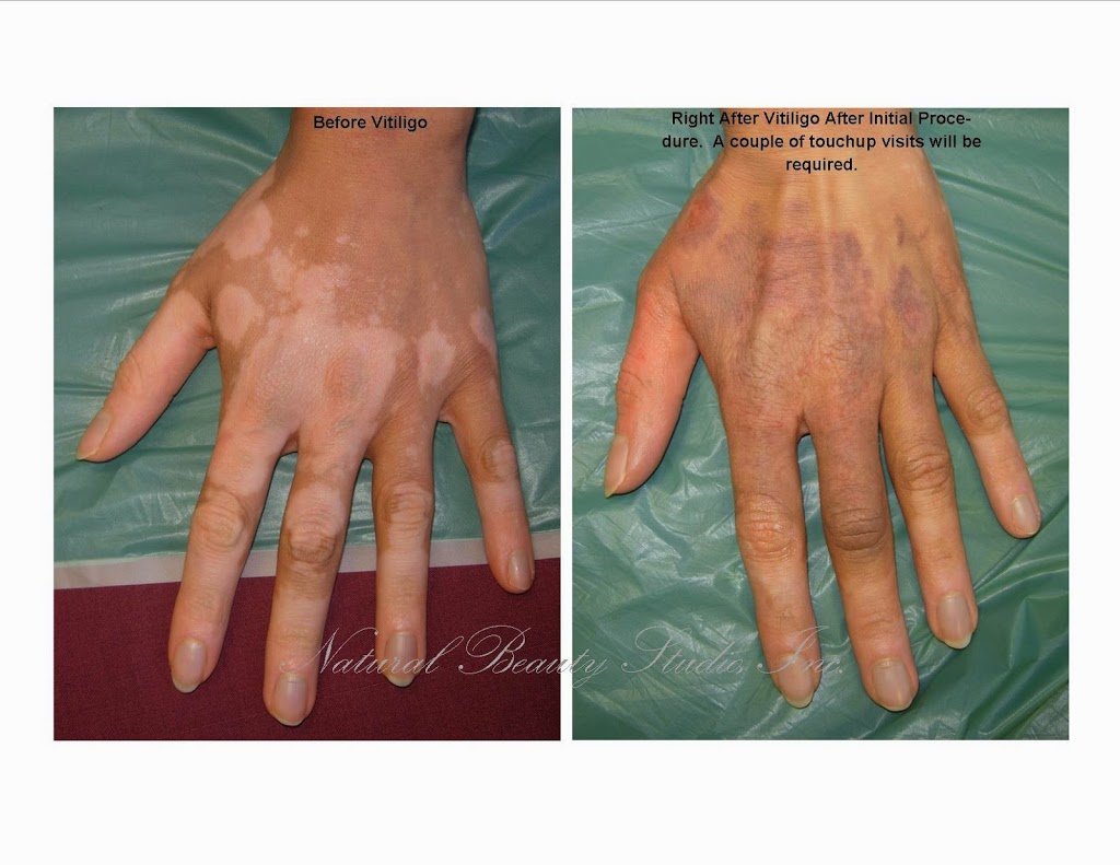 Natural Beauty Studio, Inc. | Southtowns Medical and Professional Park, 4535 Southwestern Blvd #205b, Hamburg, NY 14075, USA | Phone: (716) 713-3822
