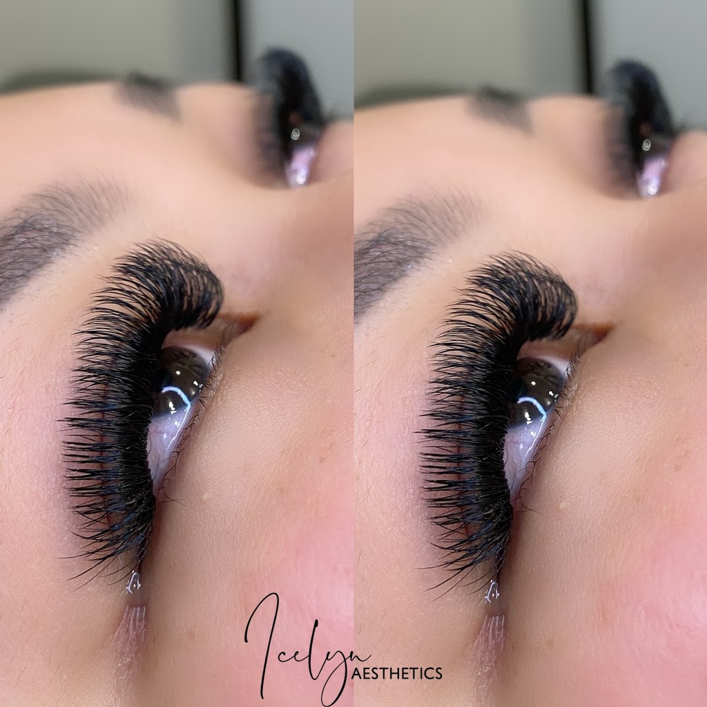 Icelyn Medical Aesthetics | 314 Etheridge Ave, Milton, ON L9E 1H7, Canada | Phone: (905) 805-4989