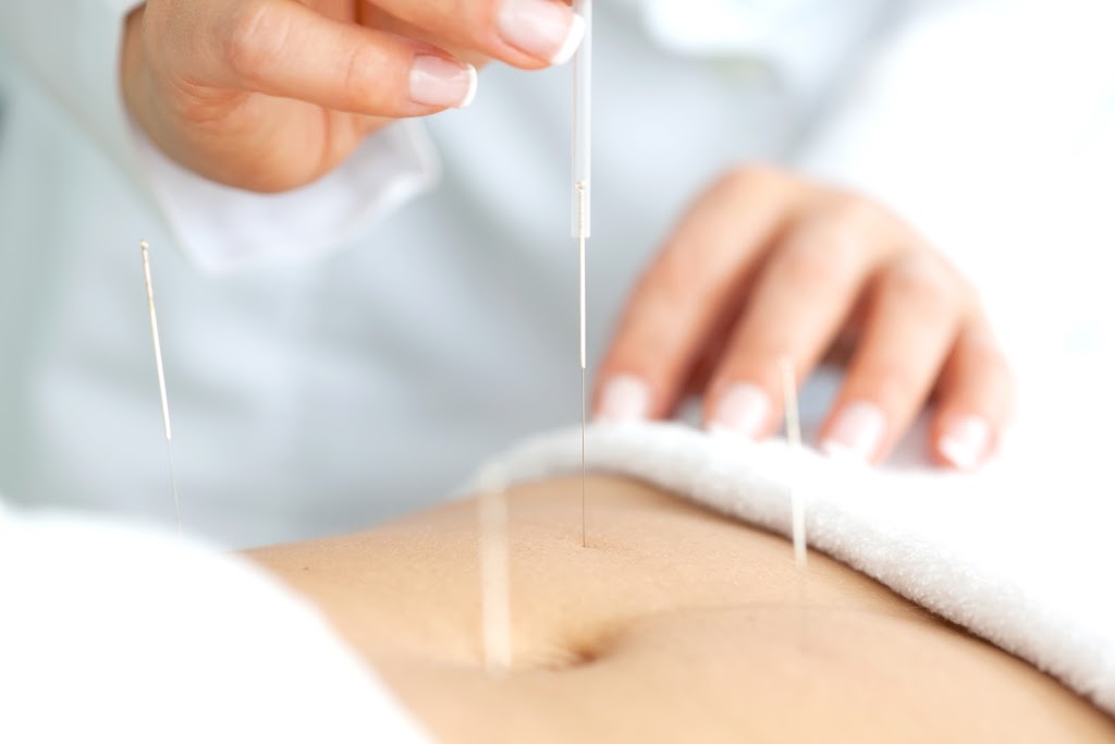 Long Fortune Acupuncture | 2200 McPhillips St Unit 55, Winnipeg, MB R2V 3P4, Canada | Phone: (204) 306-8080