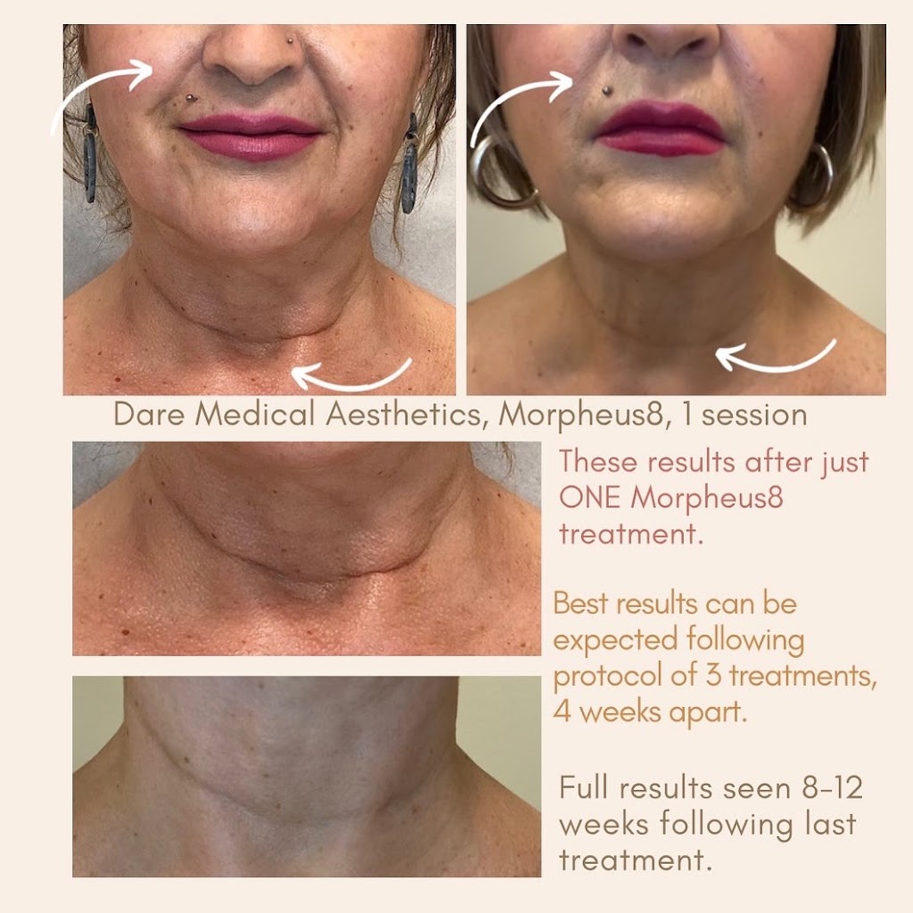 Dare Medical Aesthetics | 10003 24 St SW, Calgary, AB T2V 5K3, Canada | Phone: (403) 873-7734