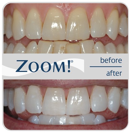 Dr. Seema Steffens Family and Cosmetic Dentistry | 4288 Dixie Rd, Mississauga, ON L4W 1M6, Canada | Phone: (905) 206-0708