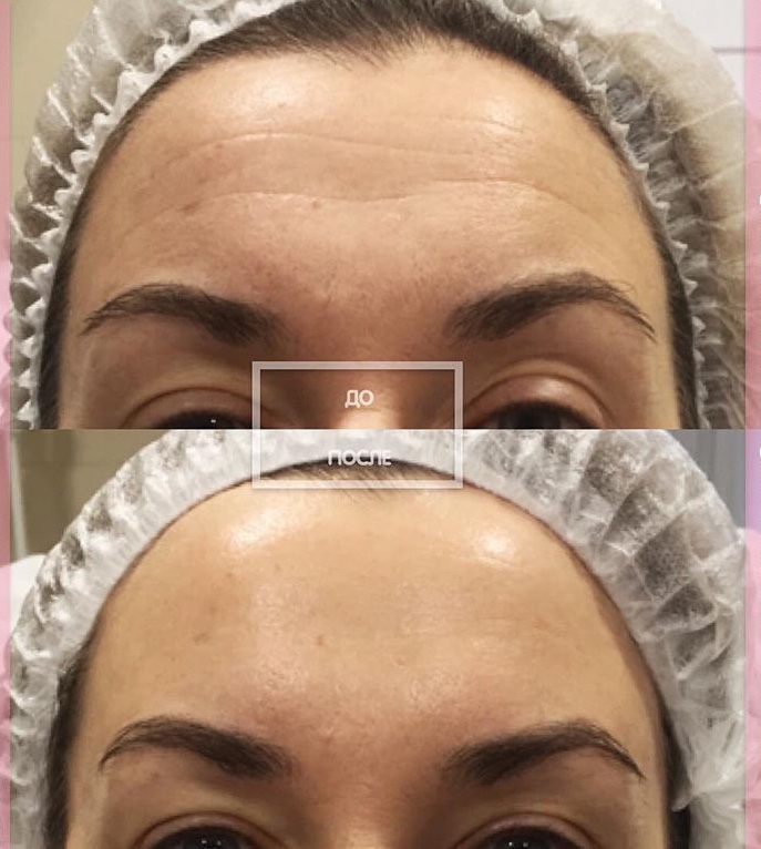 Deja Vu Beauty Services | 17O, Prince William Way #3, Barrie, ON L4M 0E5, Canada | Phone: (647) 453-7275