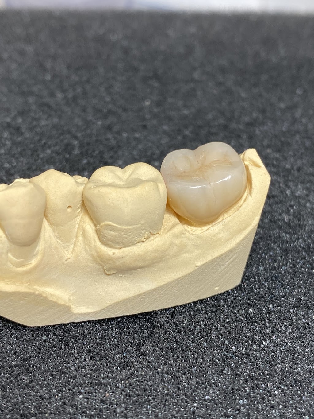 Labworks Dental Services | 10160 Ainsworth Crescent, Richmond, BC V7A 3V4, Canada | Phone: (604) 916-1875