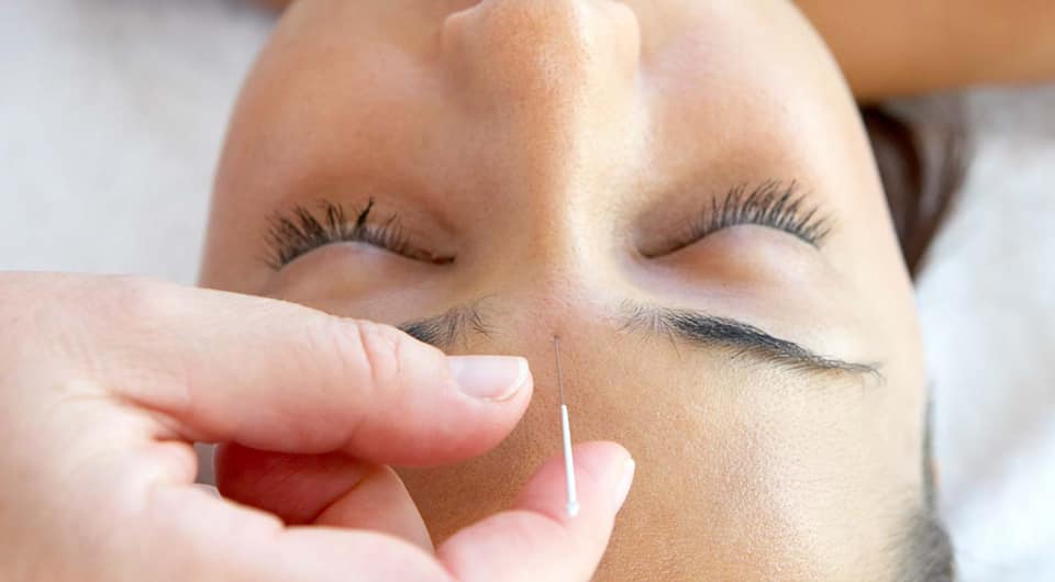 Acupuncture Geneviève Goudreault - Chicoutimi | 484 Bd du Royaume O suite 380.12, Chicoutimi, QC G7H 0S7, Canada | Phone: (418) 272-2722