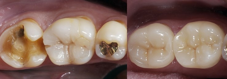 Dental Arts Clinic | 3175 Rutherford Rd unit 36, Concord, ON L4K 5Y6, Canada | Phone: (905) 761-1181