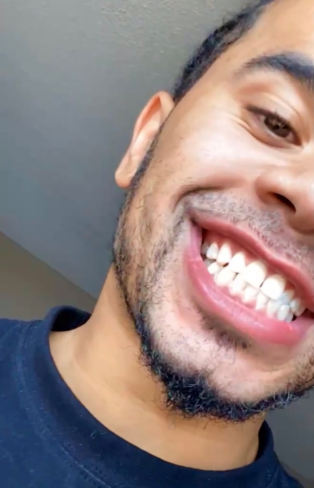 Blanche Smiles | 274 Markham Rd, Scarborough, ON M1J 3C5, Canada | Phone: (416) 885-1311