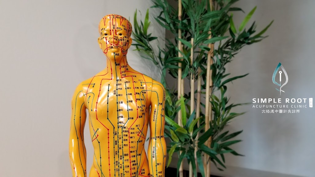 Simple Root Acupuncture Clinic | 5586 Windermere Blvd #204, Edmonton, AB T6W 2Z8, Canada | Phone: (780) 988-4488
