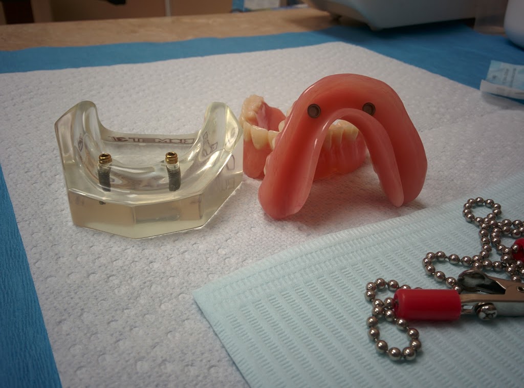 Lima Denture and Implant Solutions | 1580 Merivale Rd Unit 16, Nepean, ON K2G 4B5, Canada | Phone: (613) 224-1001
