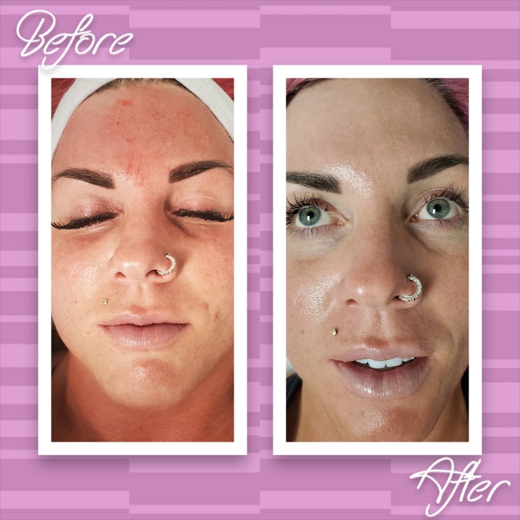 Vitality Esthetics & Medspa | 100 Kent St #140, Red Deer, AB T4P 4E5, Canada | Phone: (587) 815-5099