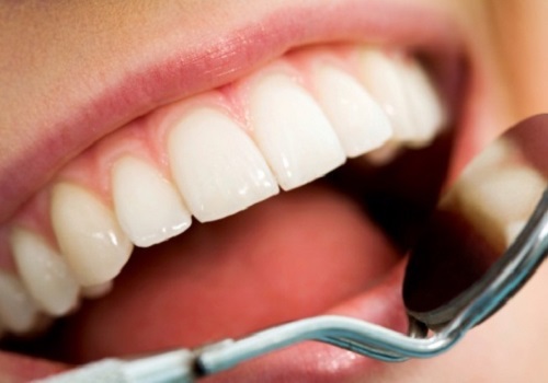 Dentisterie Du Bergerac - Dentiste Laval | 2864 Bd Daniel-Johnson, Laval, QC H7P 5Z7, Canada | Phone: (450) 505-2525