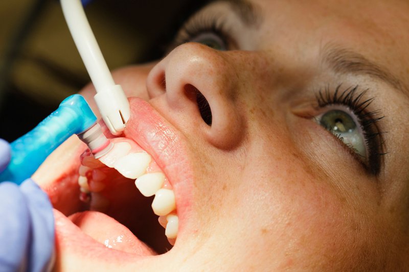Skymark Smile Centre | 25 Kingsbridge Garden Cir Unit 10, Mississauga, ON L5R 4B1, Canada | Phone: (289) 201-2480