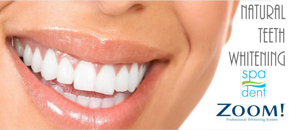 Jasmine Dental Hygiene | 1065 Walkowski Place Northwest, Edmonton, AB T6W 3G7, Canada | Phone: (780) 244-3368