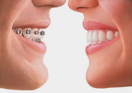 Dundas Orthodontics - Dr. Ross Fiore, Orthodontist | 231 King St W, Dundas, ON L9H 1V7, Canada | Phone: (905) 628-5717