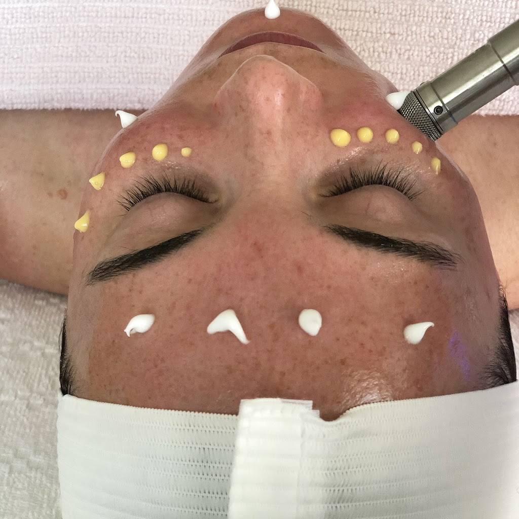 Face Appeal | 3203 Signal Hill Dr, Calgary, AB T3H 3T4, Canada | Phone: (587) 777-1565