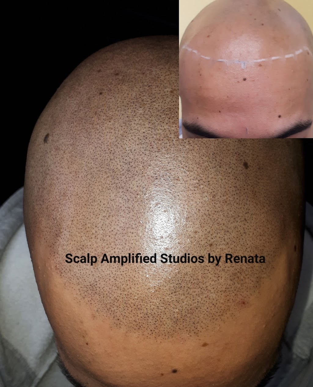 Scalp Amplified Studios | 987 King St E Unit 205, Hamilton, ON L8M 1C6, Canada | Phone: (905) 929-9250