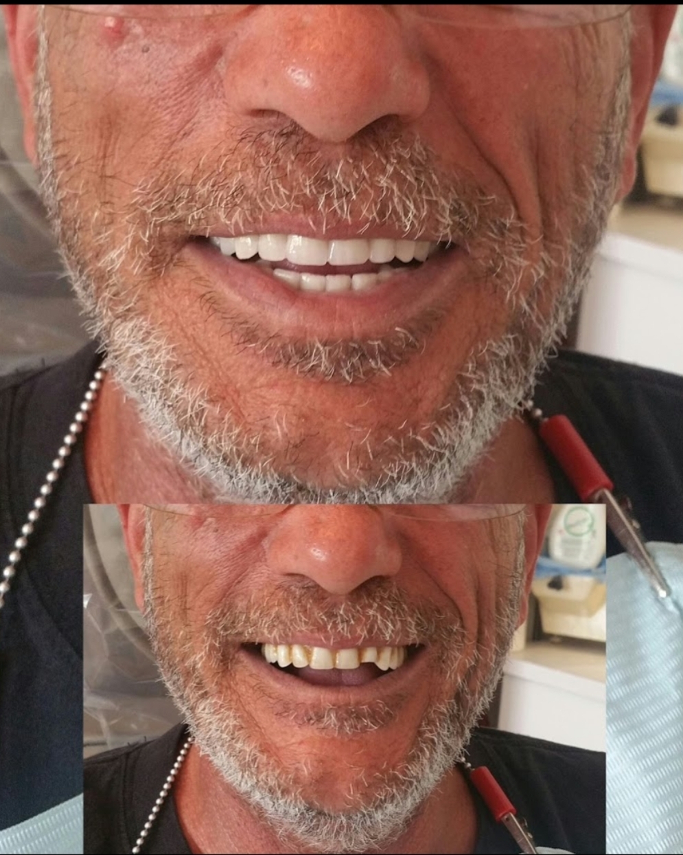 Denturologiste Rivière Rouge | 716 Rue LAnnonciation N Suite 202, Rivière-Rouge, QC J0T 1T0, Canada | Phone: (819) 275-2418