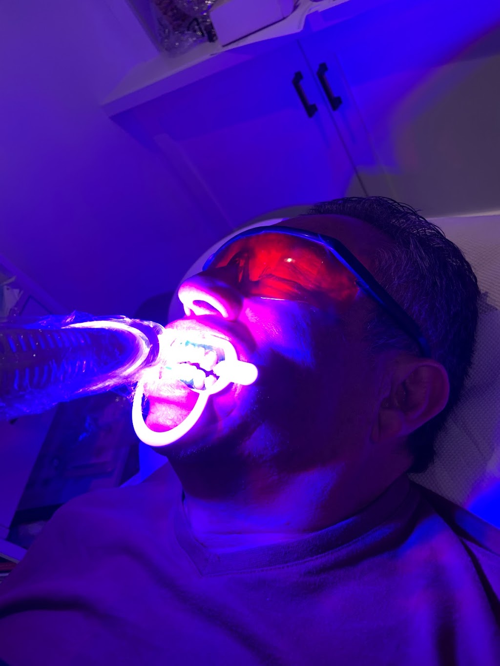 Vive Smile Beauty Studio | 3275 Stalybridge Dr #42, Oakville, ON L6M 0L2, Canada | Phone: (416) 731-9802