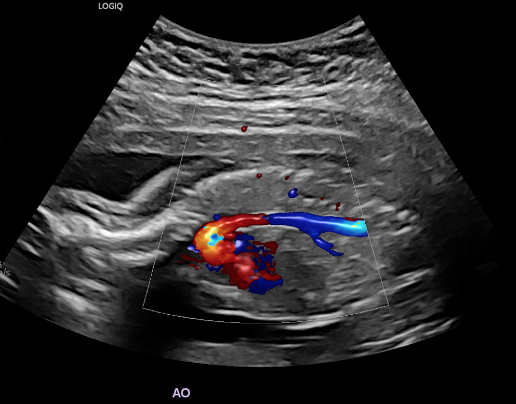 Southwest Ultrasound | 460 Wellington St, St Thomas, ON N5R 6H9, Canada | Phone: (519) 631-8531
