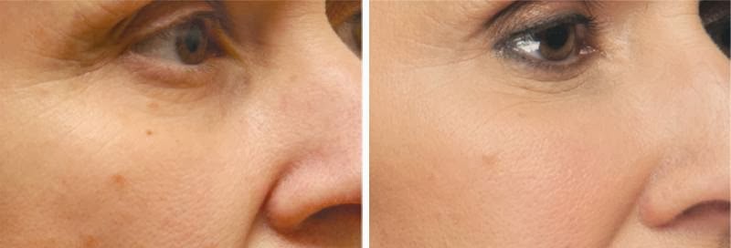 Dr Suzanne Leaf Cosmetic Clinic | 189 Elm St, St Thomas, ON N5R 5C4, Canada | Phone: (519) 207-5323