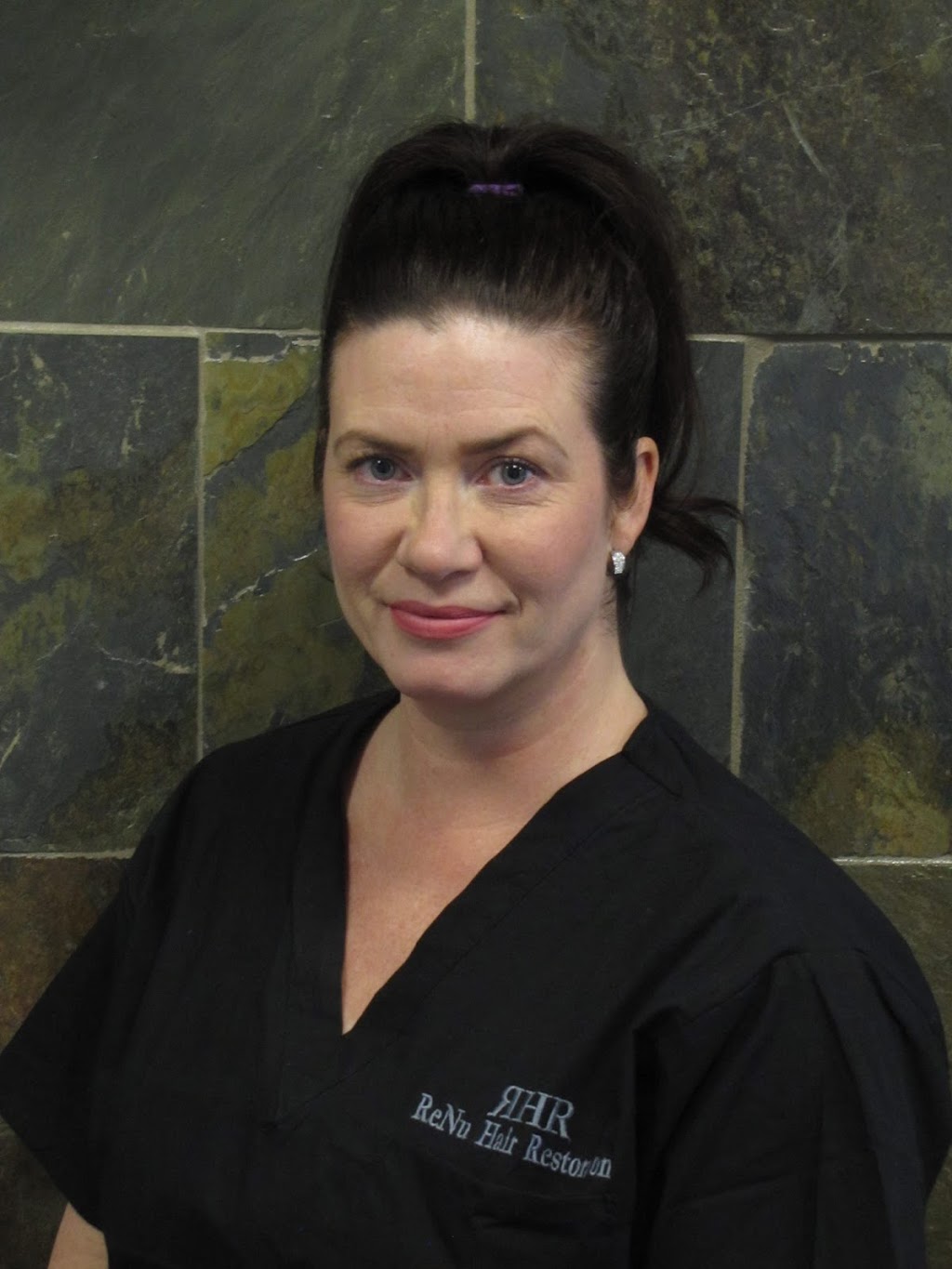 ReNu Hair Restoration | 8730 Country Hills Blvd NW #240, Calgary, AB T3G 0E2, Canada | Phone: (403) 567-2045