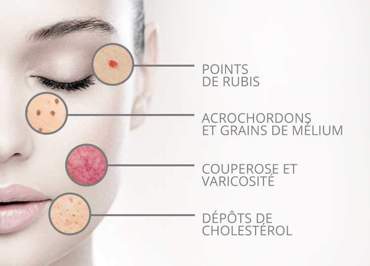 Esthétique Outremont | 1331 Av. Ducharme, Montréal, QC H2V 1E7, Canada | Phone: (514) 277-2022