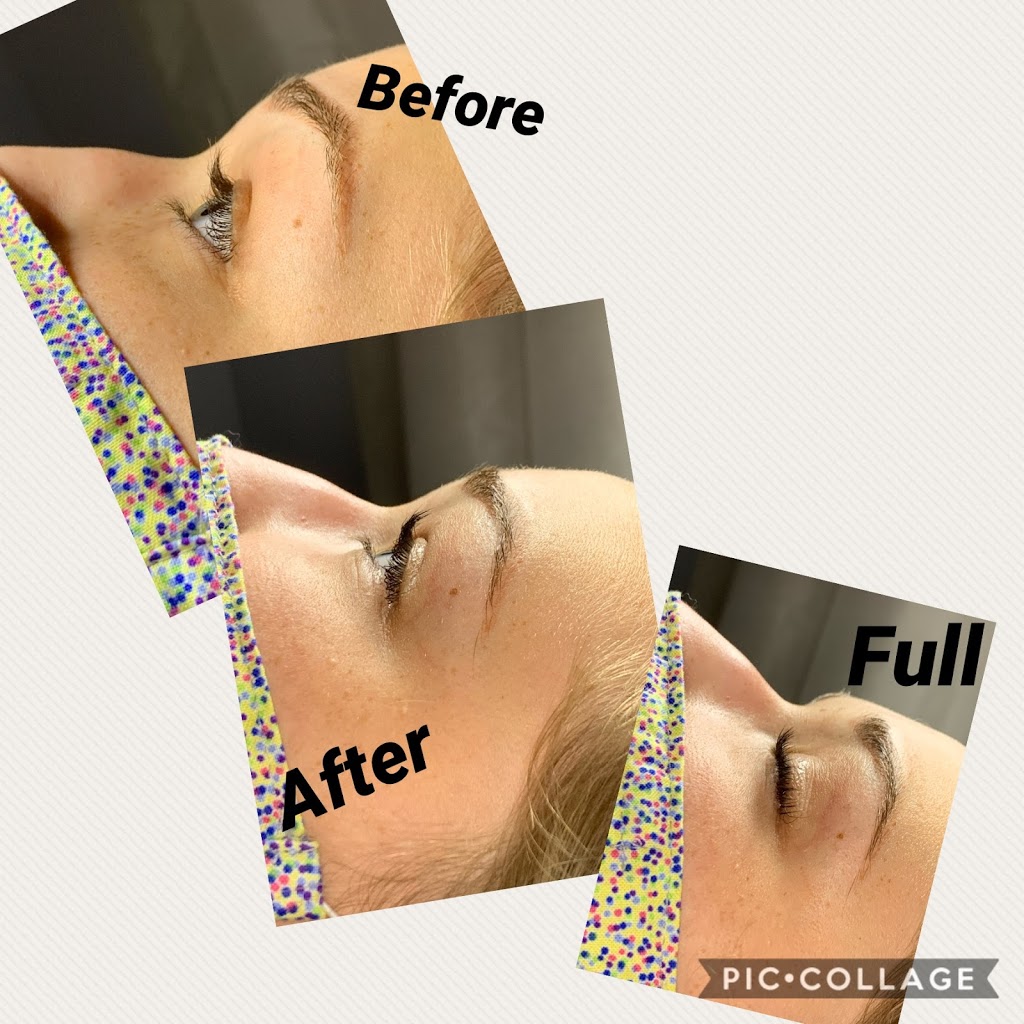 LaserHaven & Beauty | 2480 Strandherd Dr, Nepean, ON K2G 4S4, Canada | Phone: (613) 265-6932
