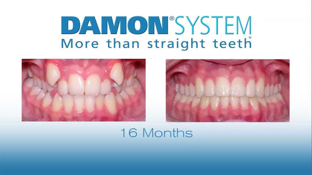 Centre Dentaire Lakeshore | 22 Rue Canvin, Kirkland, QC H9H 4S4, Canada | Phone: (514) 694-5716
