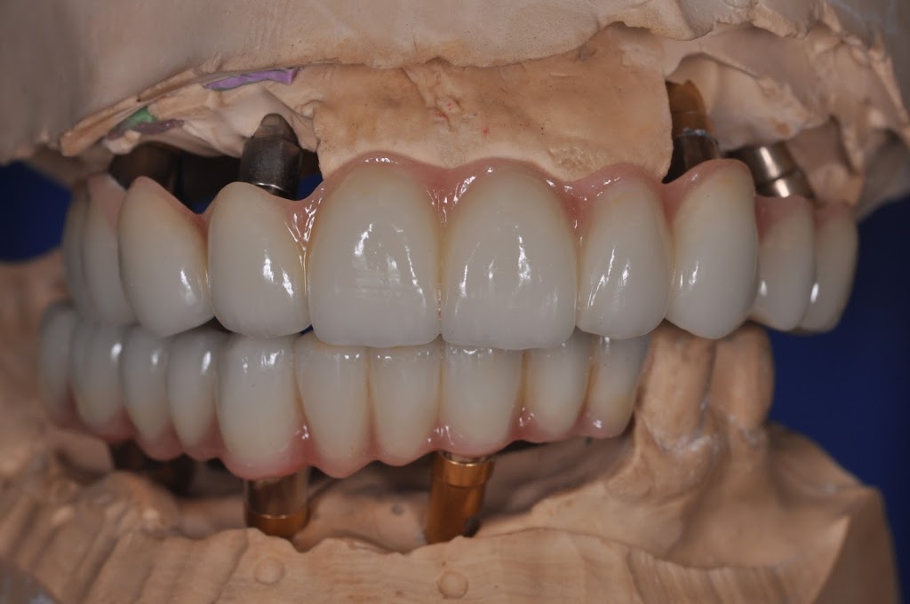 Cad Crowns Ca Inc | 210-1580 Merivale Rd, Nepean, ON K2G 4B5, Canada | Phone: (613) 723-7300