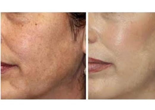 Beauty tech | 393 Vaughan Rd, York, ON M6C 2N8, Canada | Phone: (437) 242-4899