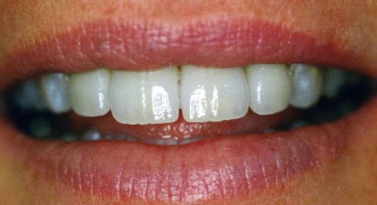 Second Nature Dental Innovations | 620 Alden Rd, Markham, ON L3R 9R7, Canada | Phone: (905) 752-0144