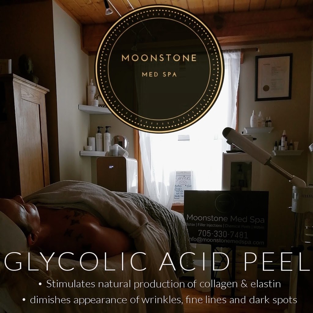 Moonstone Med Spa | 691 Mt St Louis Rd W, Hillsdale, ON L0L 1V0, Canada | Phone: (705) 330-1802