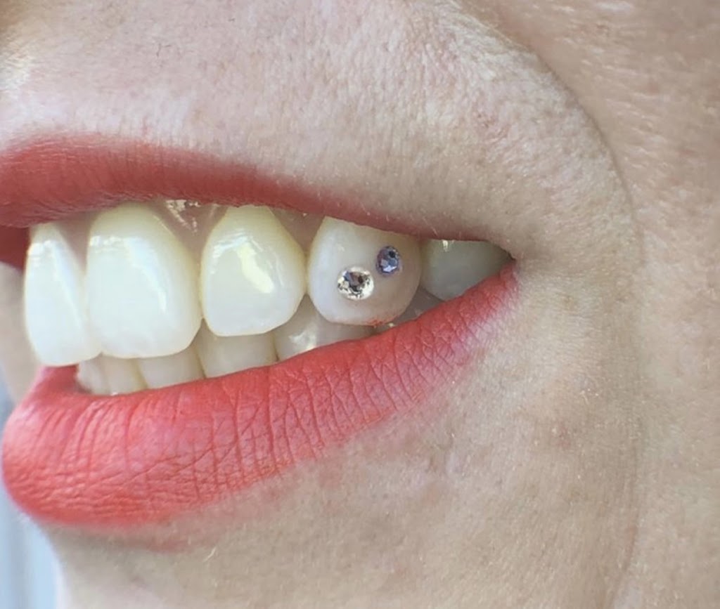 Tooth Gemist & Teeth Whitening Technician by Deanna | 32 Dorthy Dr, Trenton, ON K8V 5P5, Canada | Phone: (647) 466-1695