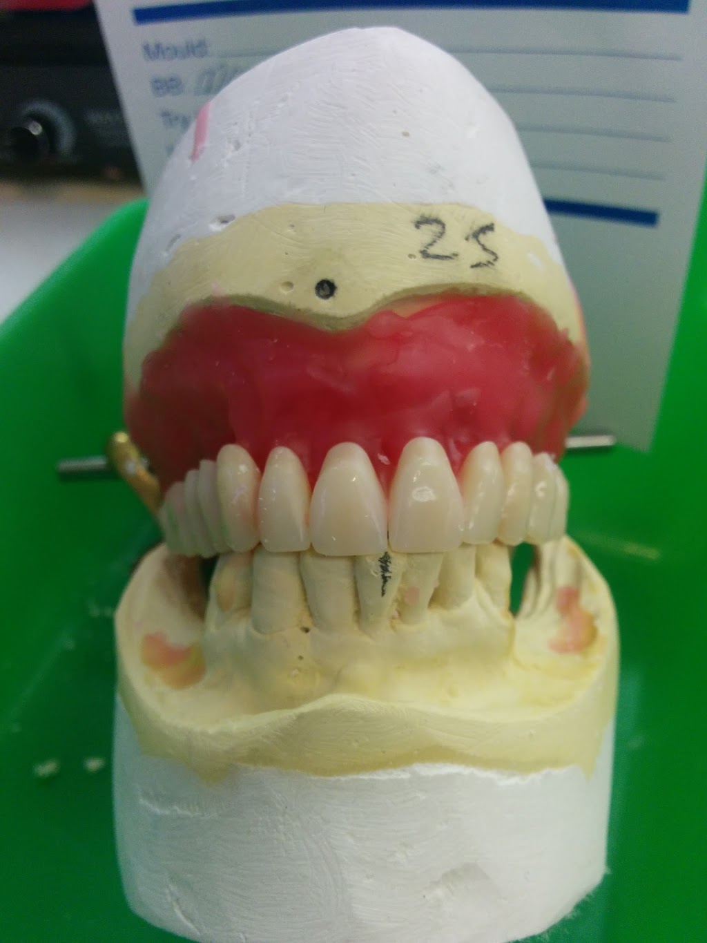 Lima Denture and Implant Solutions | 797 Richmond Rd, Ottawa, ON K2A 0G7, Canada | Phone: (613) 728-5532