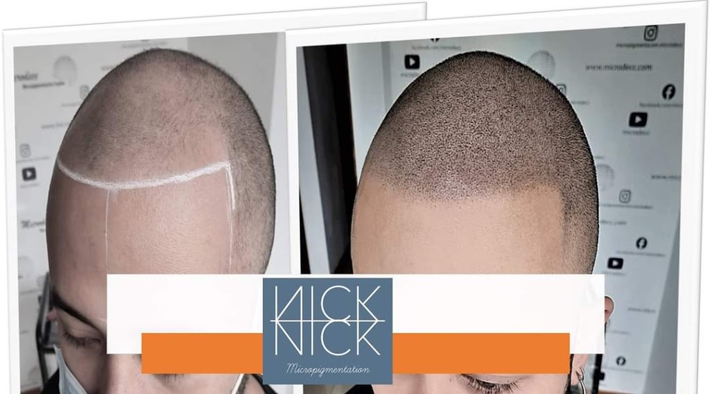 Nick Micropigmentation | 6150 Valley Way Unit A118, Niagara Falls, ON L2E 1X9, Canada | Phone: (289) 321-2183