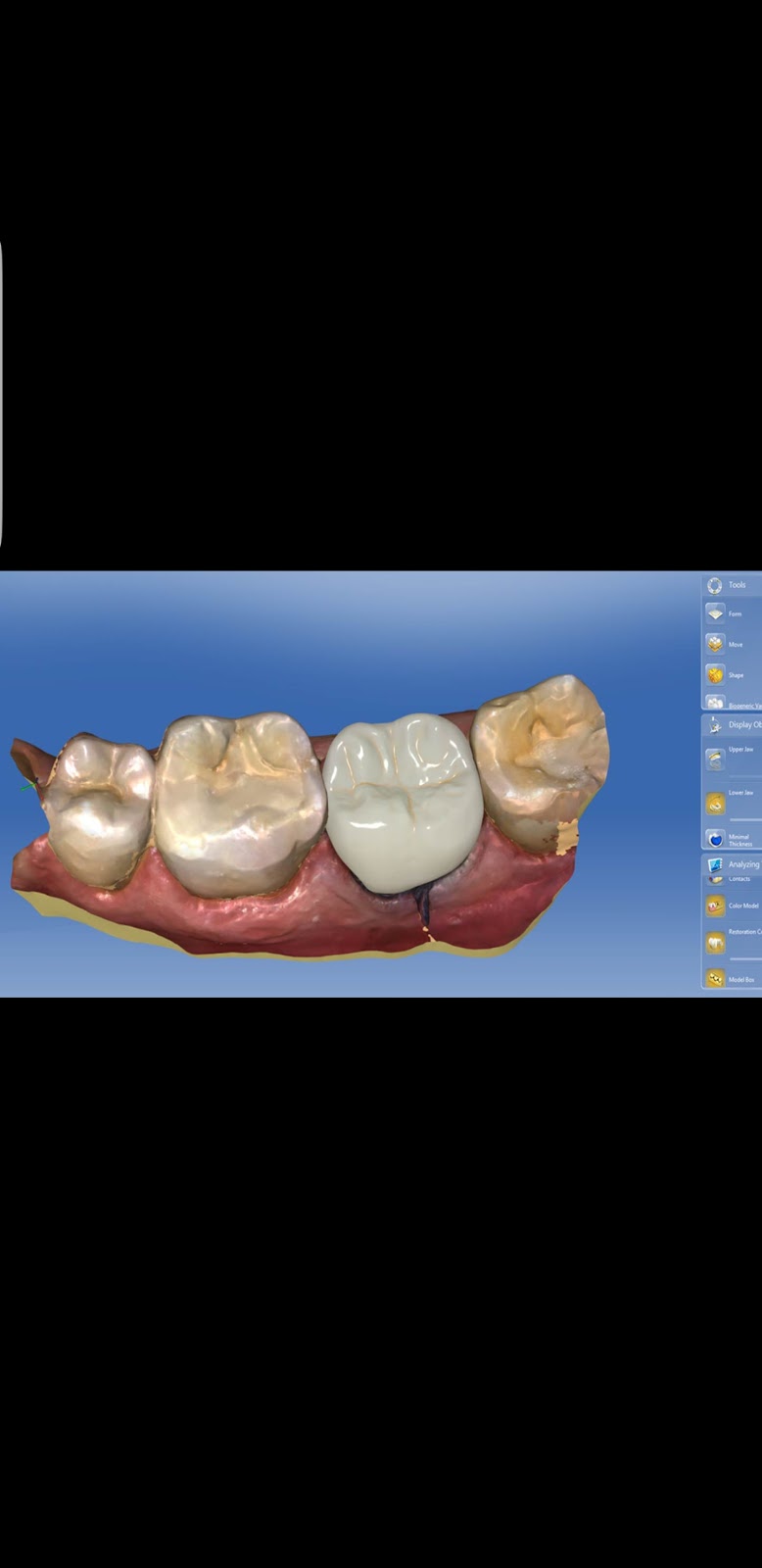 Langdon Dental | 355 Centre St #109, Langdon, AB T0J 1X2, Canada | Phone: (403) 936-8432