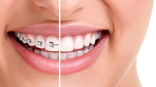 Saddleback Dental Centre | 378 Saddleback Rd NW, Edmonton, AB T6J 4R7, Canada | Phone: (780) 437-4872