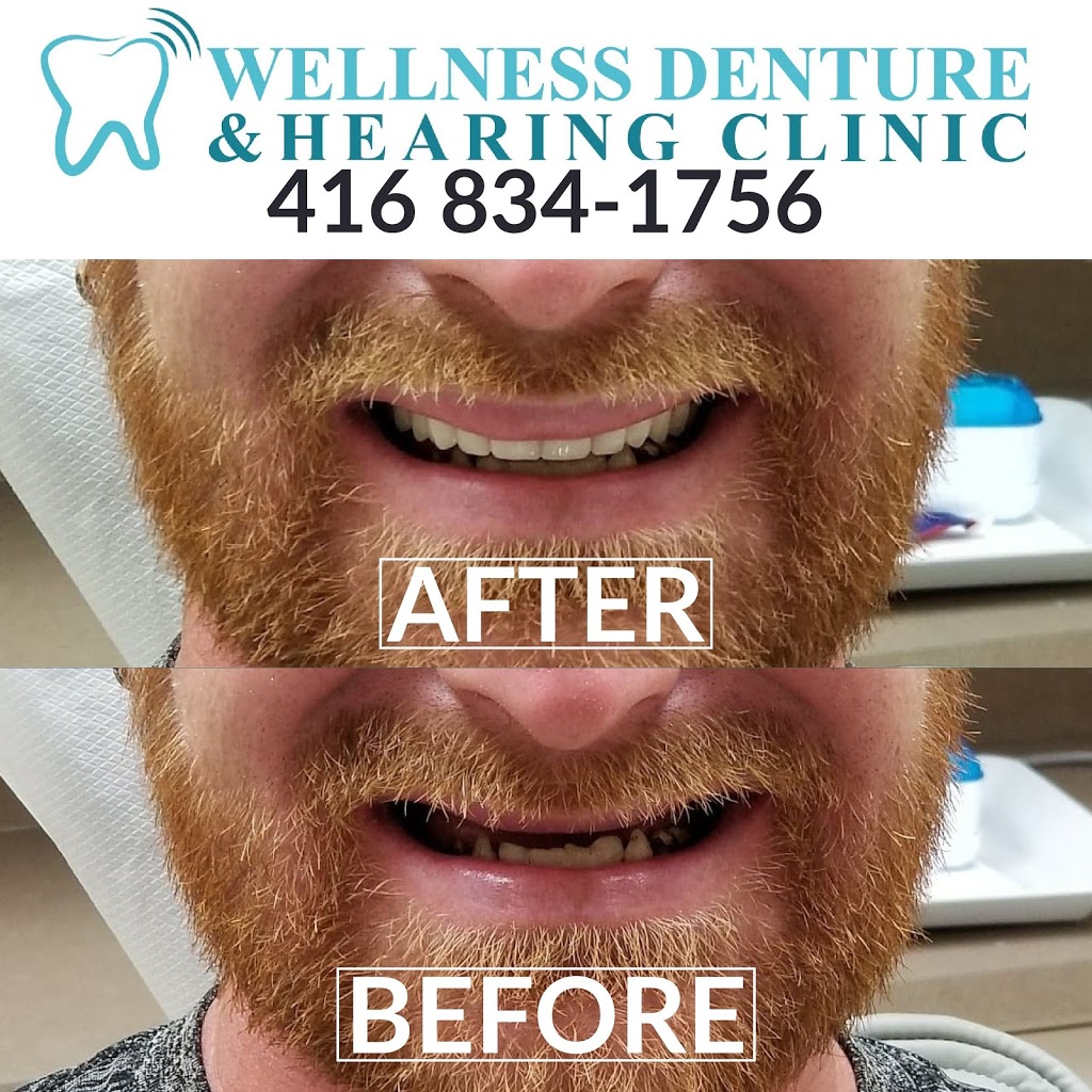 Wellness Denture And Hearing Clinic | 200 Queens Plate Dr unit c2, Etobicoke, ON M9W 6Y9, Canada | Phone: (416) 834-1756
