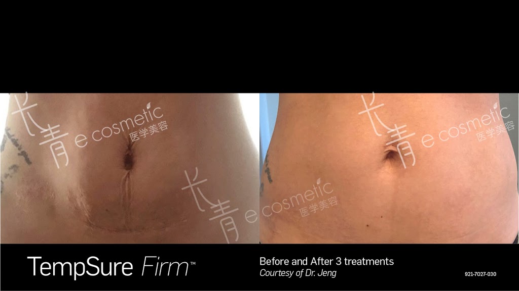 长青医学美容 - Evergreen Cosmetic | 500 Royal Oak Dr NW #216, Calgary, AB T3G 5J7, Canada | Phone: (403) 680-9960